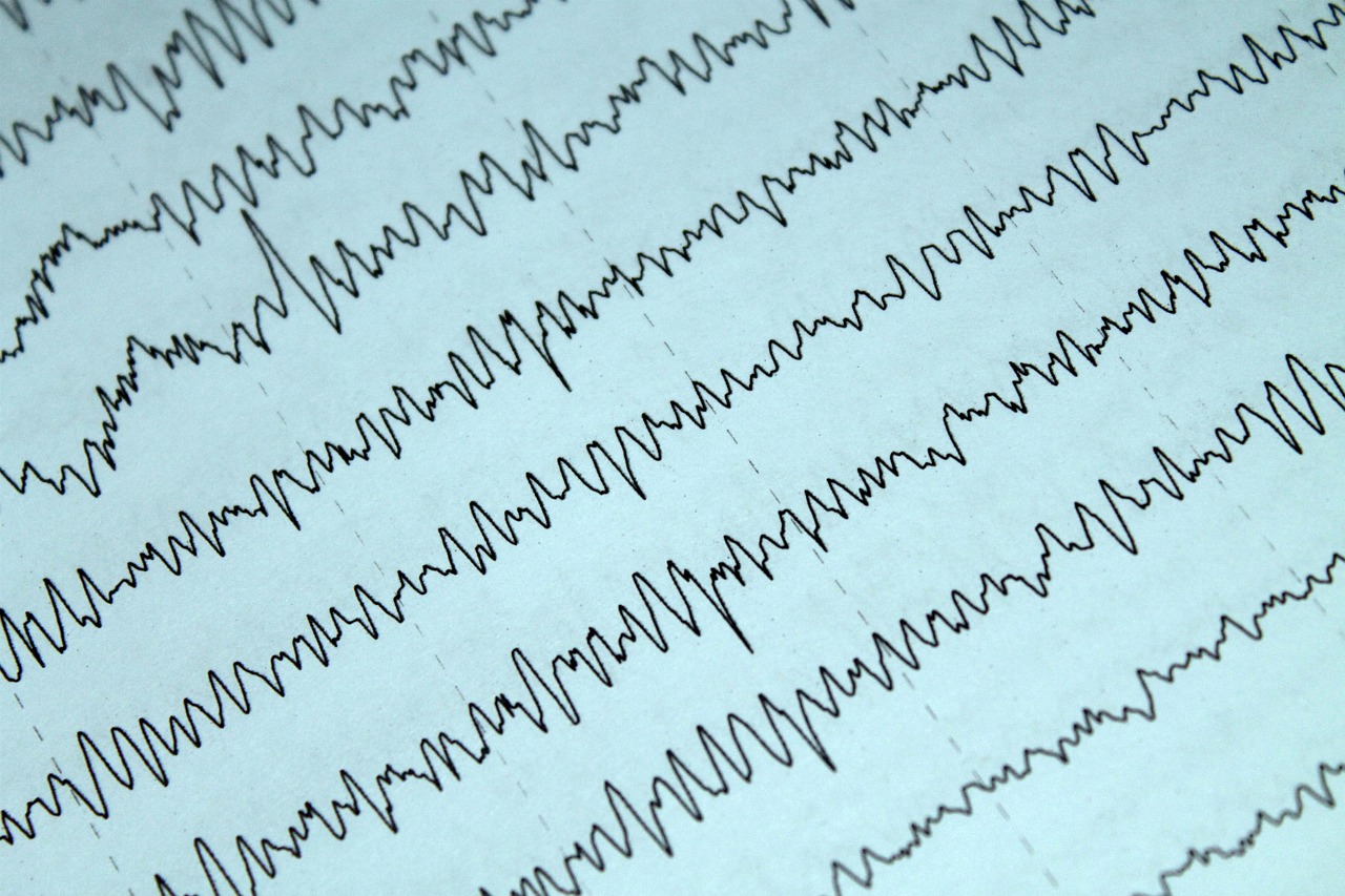 Photo: NomeVisualizzato / Pixabay Angle Health reaches a $2.7B valuation